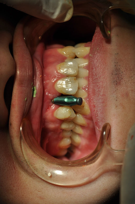 %_tempFileNameImplant%2032e1%