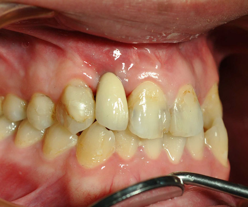 %_tempFileNameImplant%2032e4%