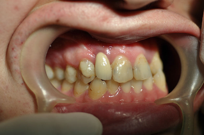 %_tempFileNameImplant%2032e6%