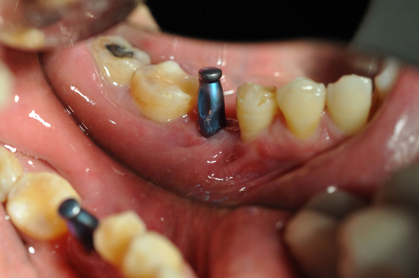 %_tempFileNameImplant%2033b%