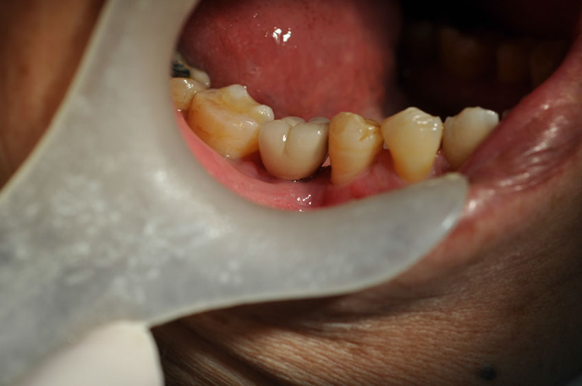 %_tempFileNameImplant%2033c%