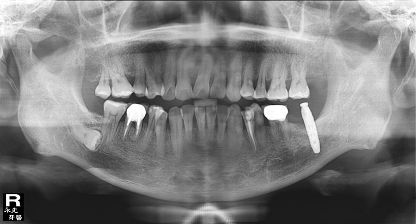 %_tempFileNameImplant%2034h3%