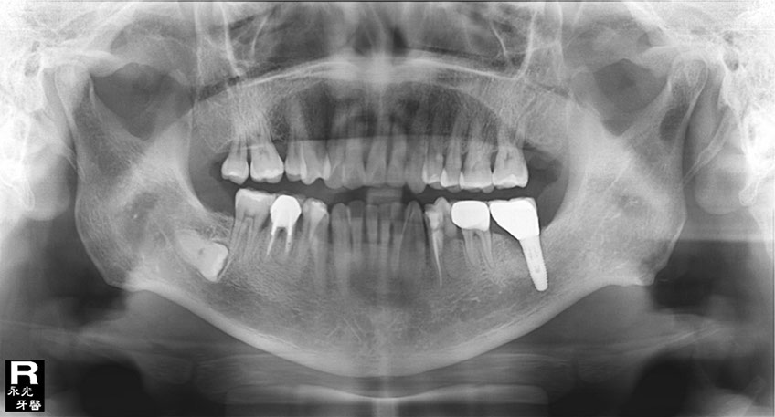 %_tempFileNameImplant%2034h4%