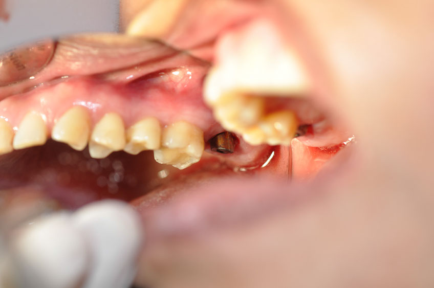 %_tempFileNameImplant%2035c%