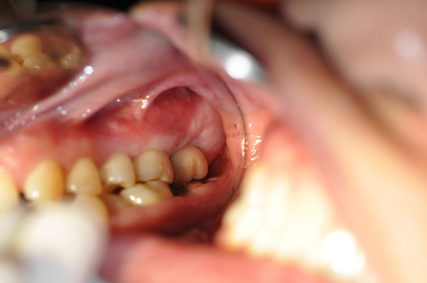 %_tempFileNameImplant%2035d%