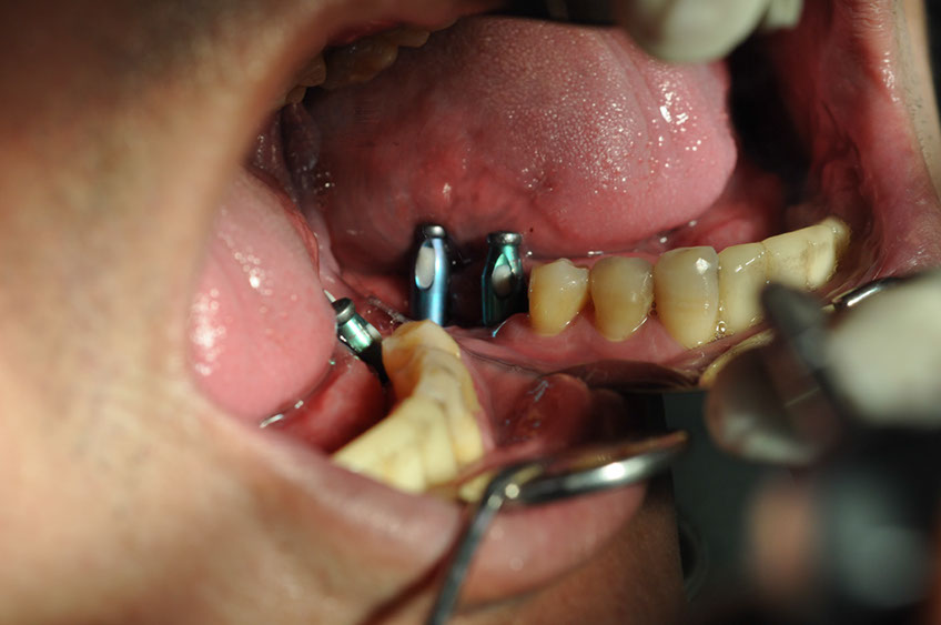 %_tempFileNameImplant%2036a3%