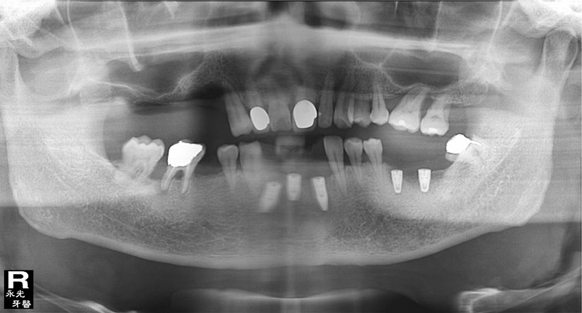%_tempFileNameImplant%2036b2%