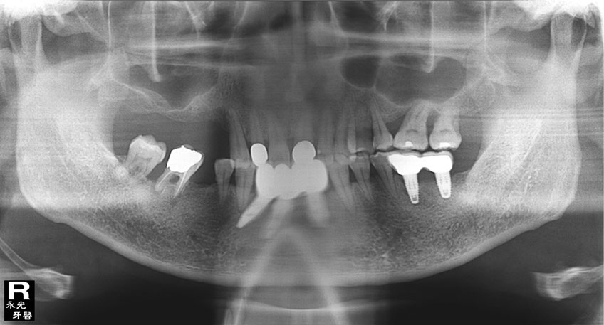 %_tempFileNameImplant%2036b3%