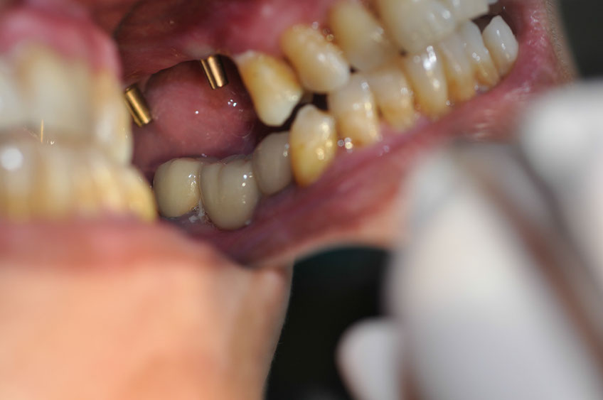%_tempFileNameImplant%2037a3%