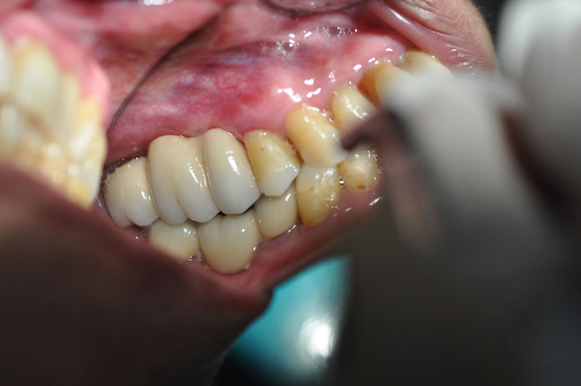 %_tempFileNameImplant%2037a4%