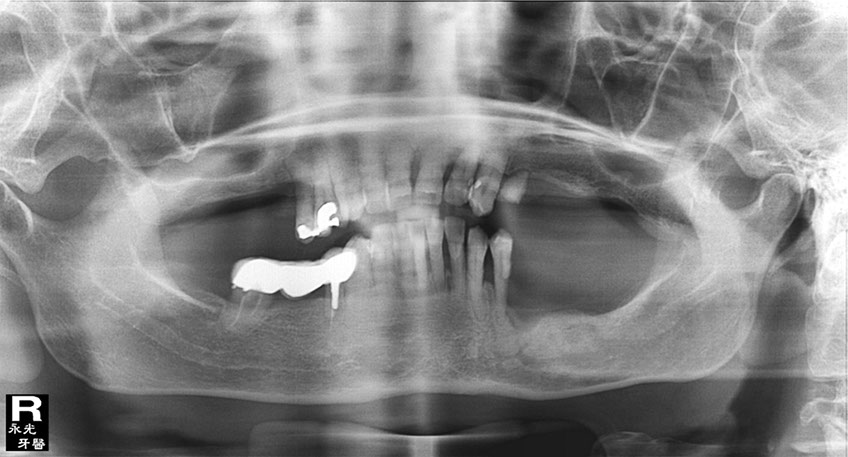 %_tempFileNameImplant%2037b2%