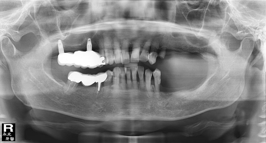 %_tempFileNameImplant%2037b4%