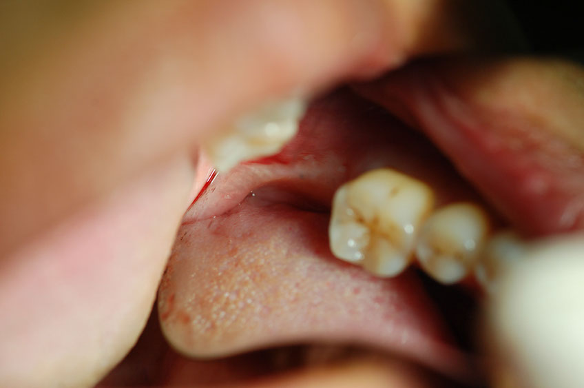 %_tempFileNameImplant%2039a%