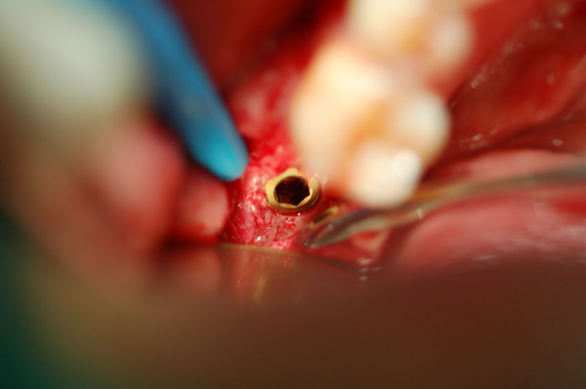 %_tempFileNameImplant%2039b%
