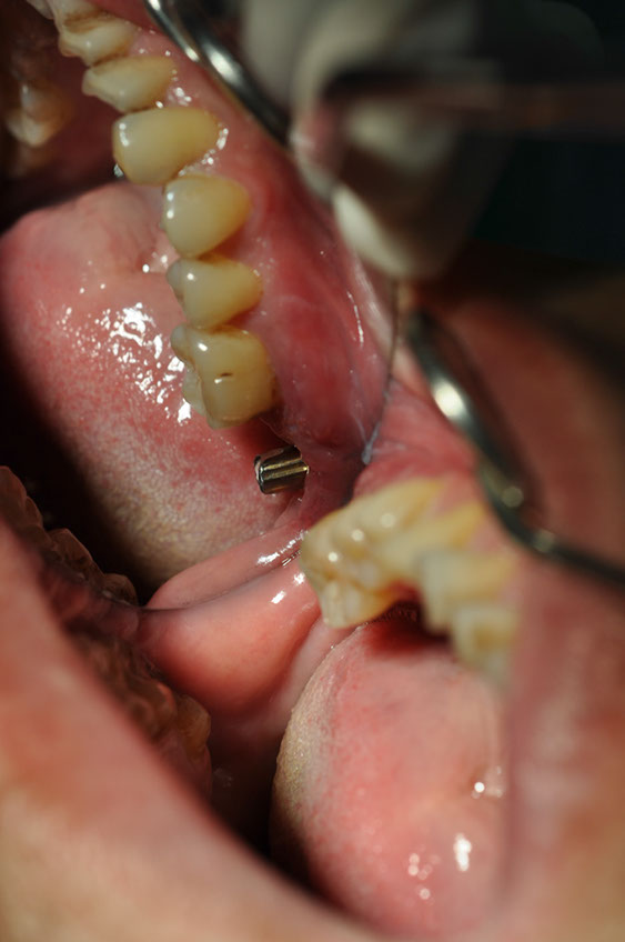 %_tempFileNameImplant%2039d%