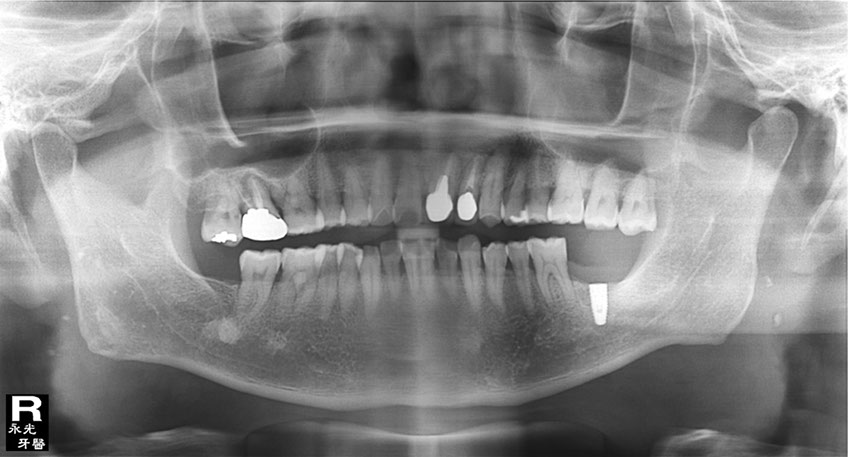 %_tempFileNameImplant%2039f%20(1)%