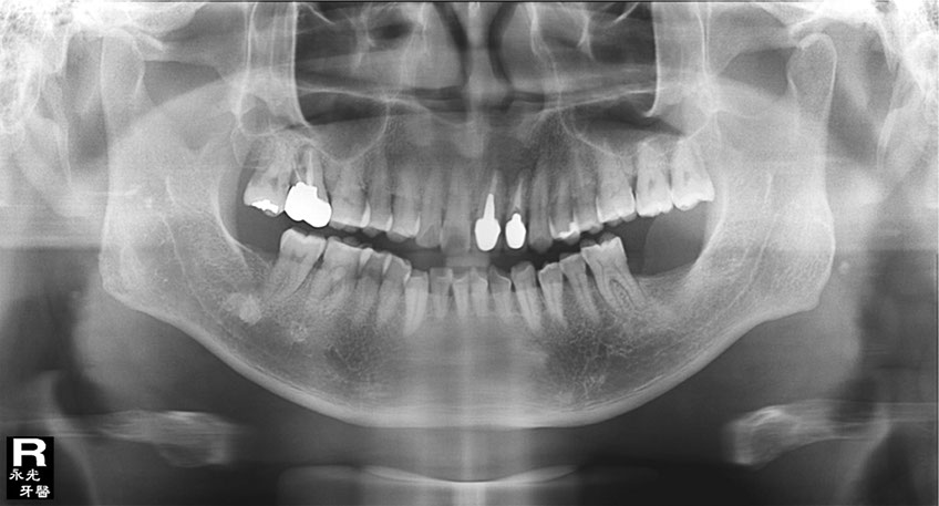 %_tempFileNameImplant%2039f%
