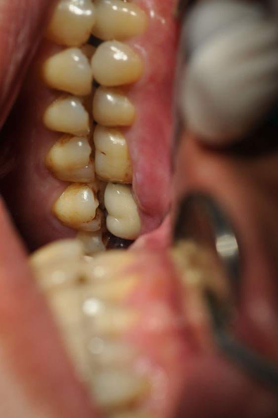 %_tempFileNameImplant%2039f2%