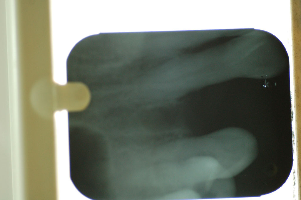 %_tempFileNameImplant%203a%