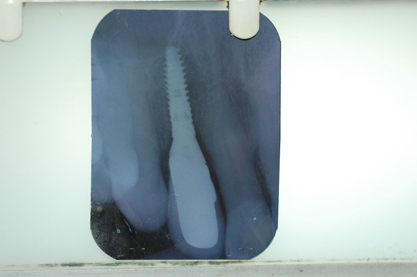 %_tempFileNameImplant%203c5%