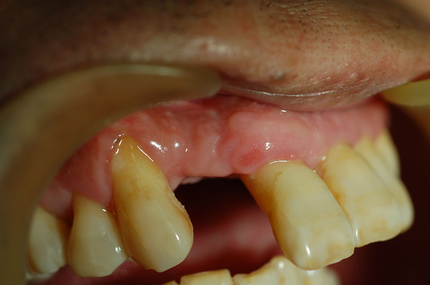 %_tempFileNameImplant%203i3%