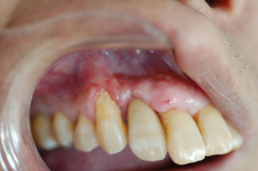 %_tempFileNameImplant%203le%
