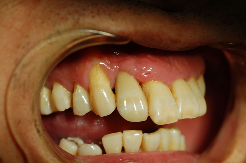 %_tempFileNameImplant%203m1%