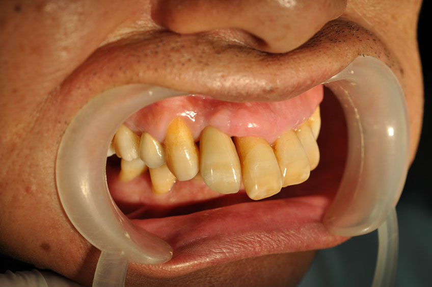 %_tempFileNameImplant%203m2%