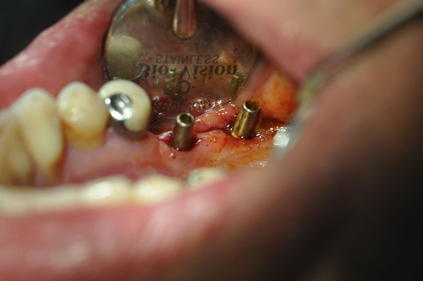 %_tempFileNameImplant%2040a4%