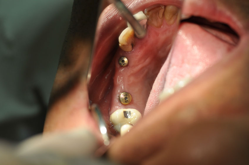 %_tempFileNameImplant%2040b3%