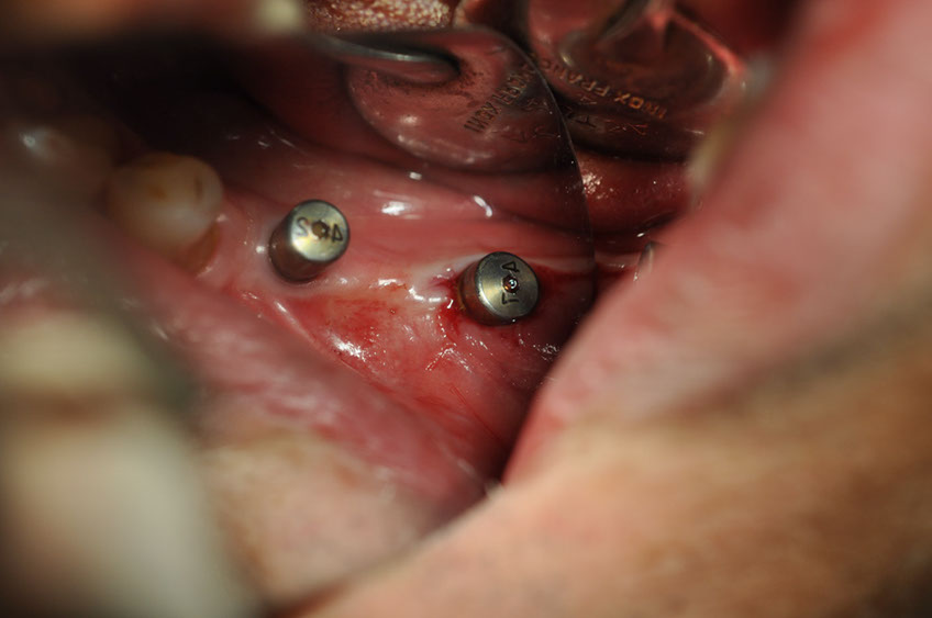 %_tempFileNameImplant%2040c4%