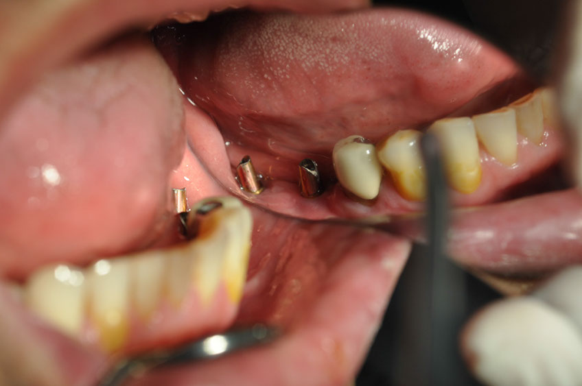 %_tempFileNameImplant%2040c6%