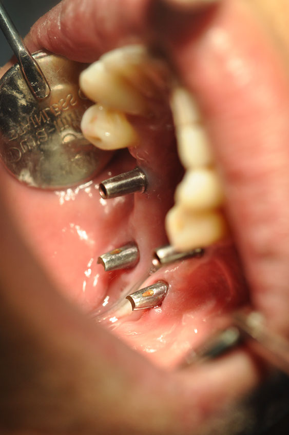 %_tempFileNameImplant%2040c8%