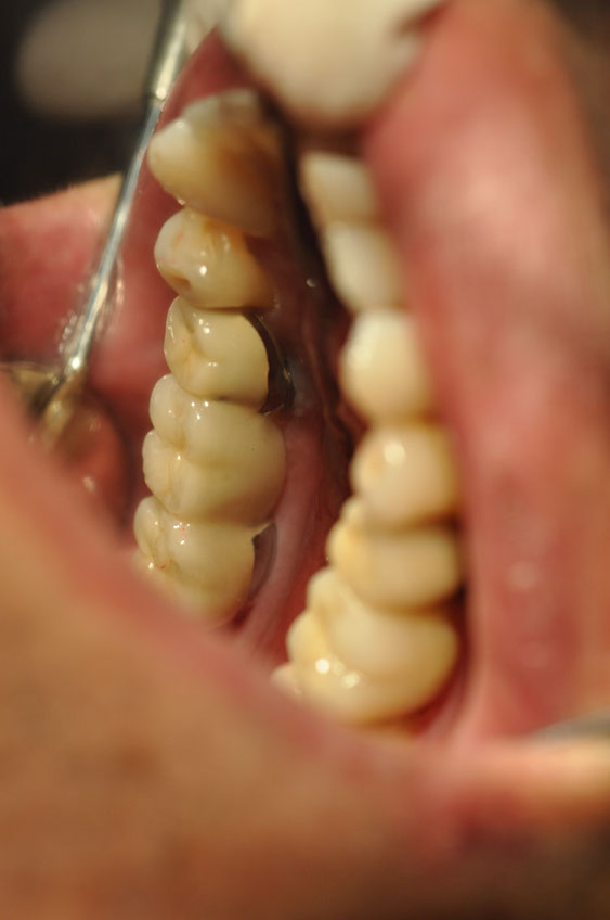 %_tempFileNameImplant%2040cb1%