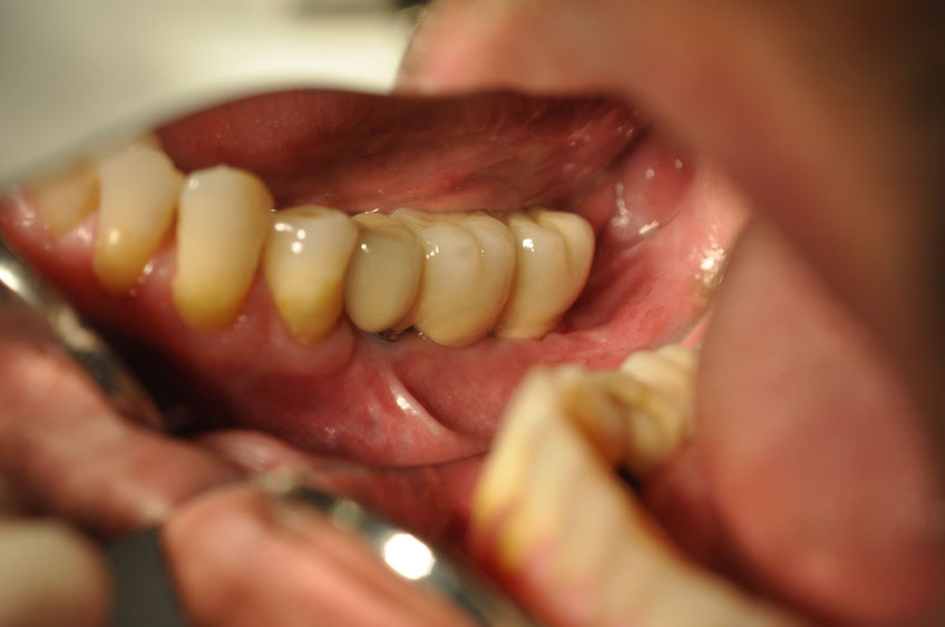 %_tempFileNameImplant%2040cb2%