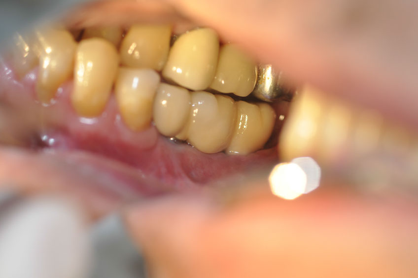 %_tempFileNameImplant%2040cb3%