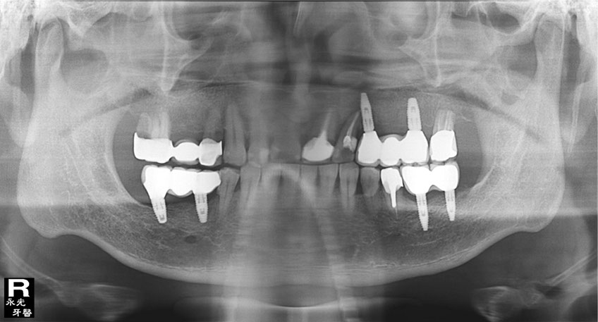 %_tempFileNameImplant%2040e3%