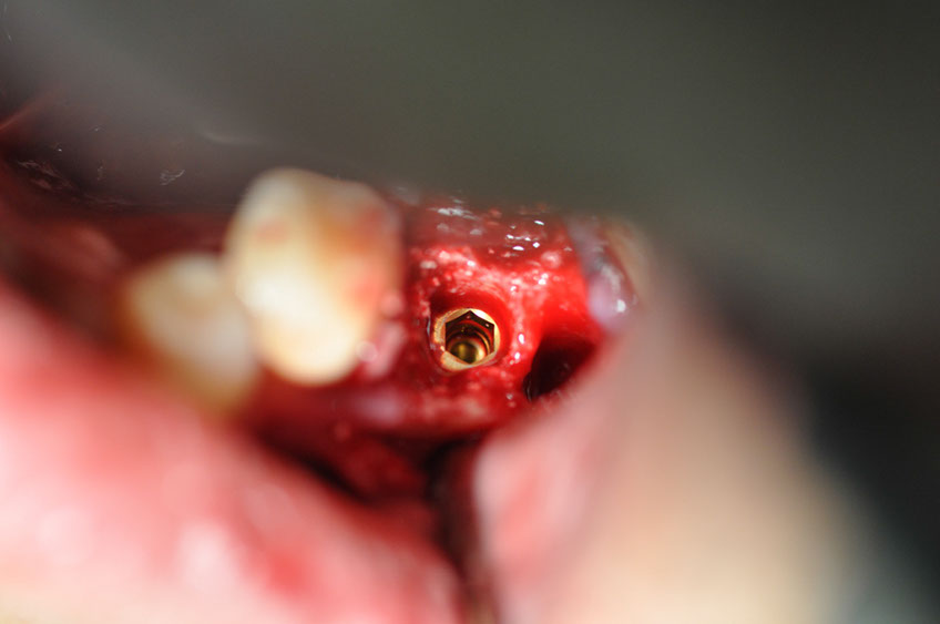 %_tempFileNameImplant%2044c%