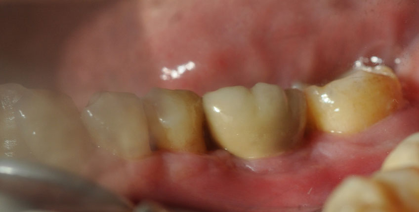 %_tempFileNameImplant%2044i2%