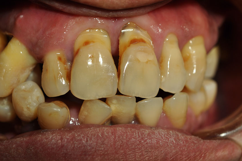 %_tempFileNameImplant%2045a1%