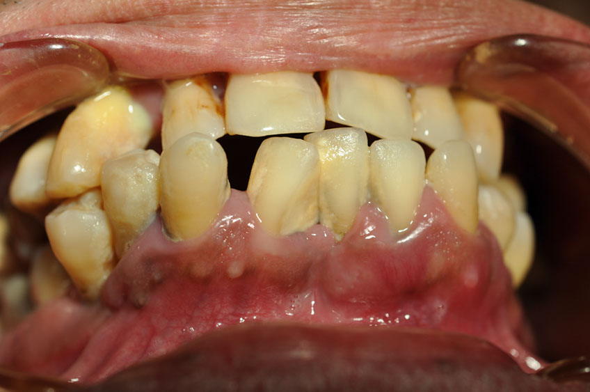 %_tempFileNameImplant%2045a2%