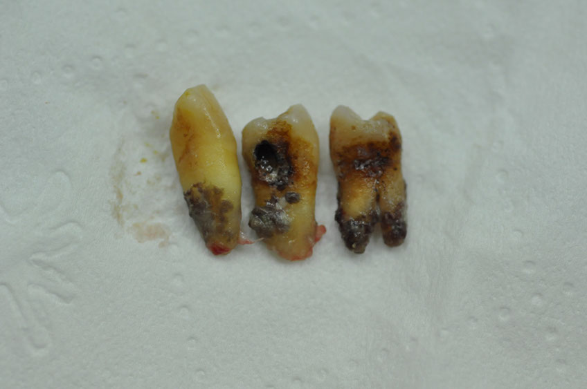 %_tempFileNameImplant%2045a4%