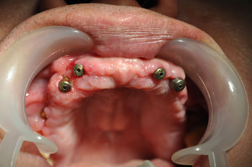 %_tempFileNameImplant%2045b1%