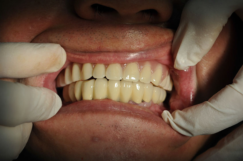 %_tempFileNameImplant%2045c1%