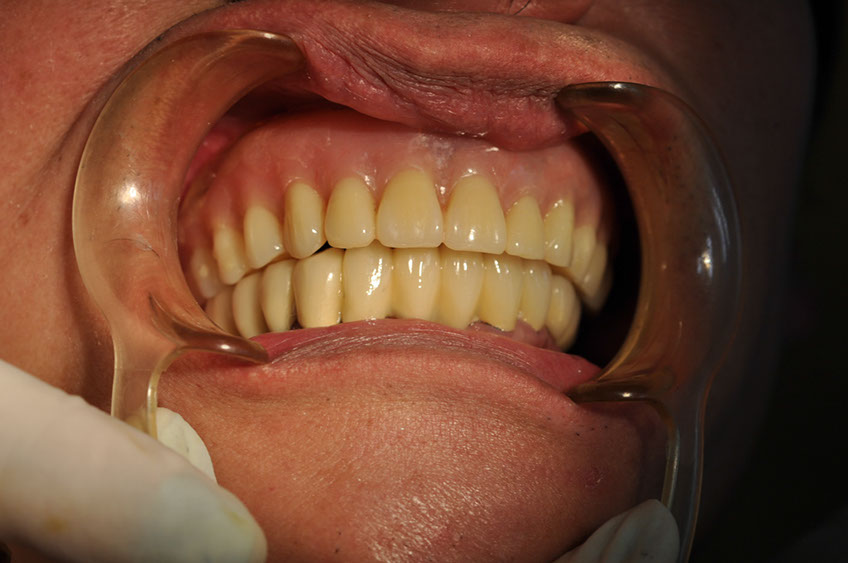 %_tempFileNameImplant%2045c8%