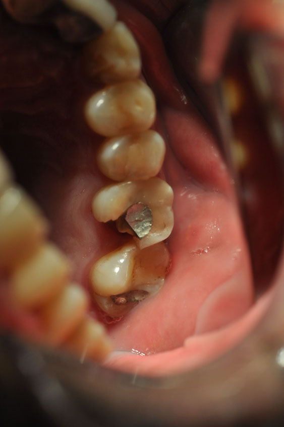 %_tempFileNameImplant%2048a1%