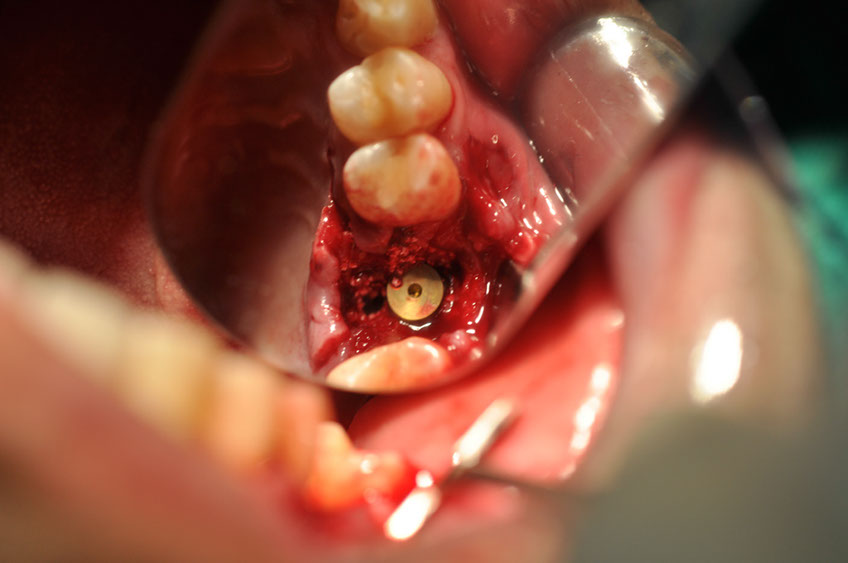 %_tempFileNameImplant%2048a5%