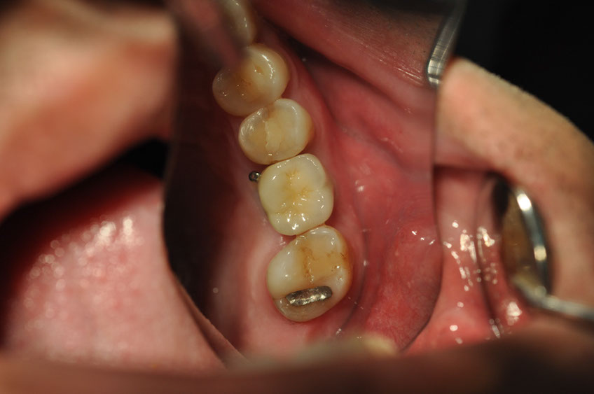 %_tempFileNameImplant%2048g1%