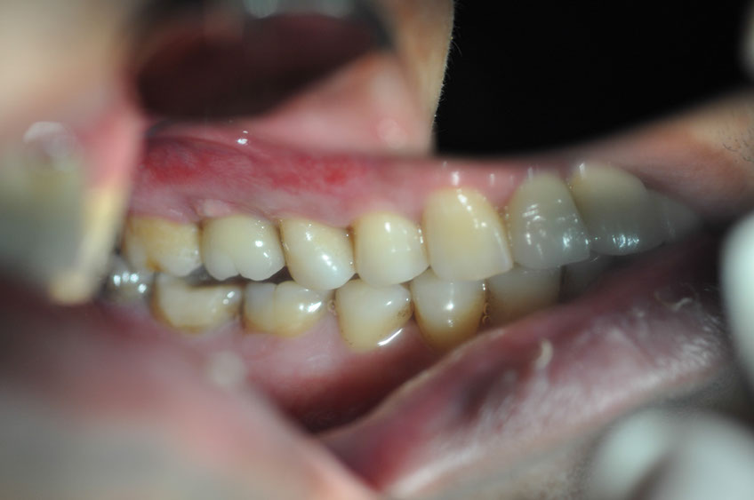 %_tempFileNameImplant%2048g2%