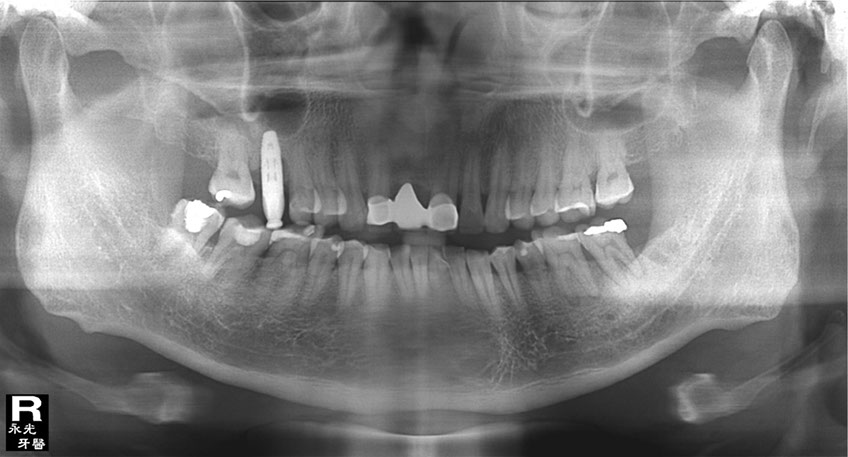 %_tempFileNameImplant%2048i3%